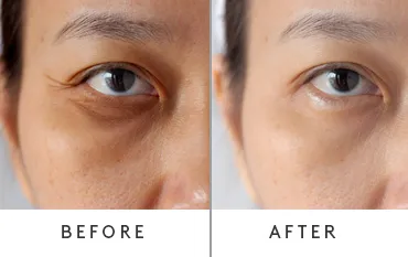 Before & After